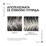 VICHY Dercos Anti-Dandruff DS, Σαμπουάν Κατά της Ξηροδερμίας, της Πιτυρίδας και του Κνησμού,Κανονικά - Λιπαρά Μαλλιά, Οικολογική Συσκευασία Refill 390ml