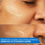 CERAVE antigiransi, oros retinolis